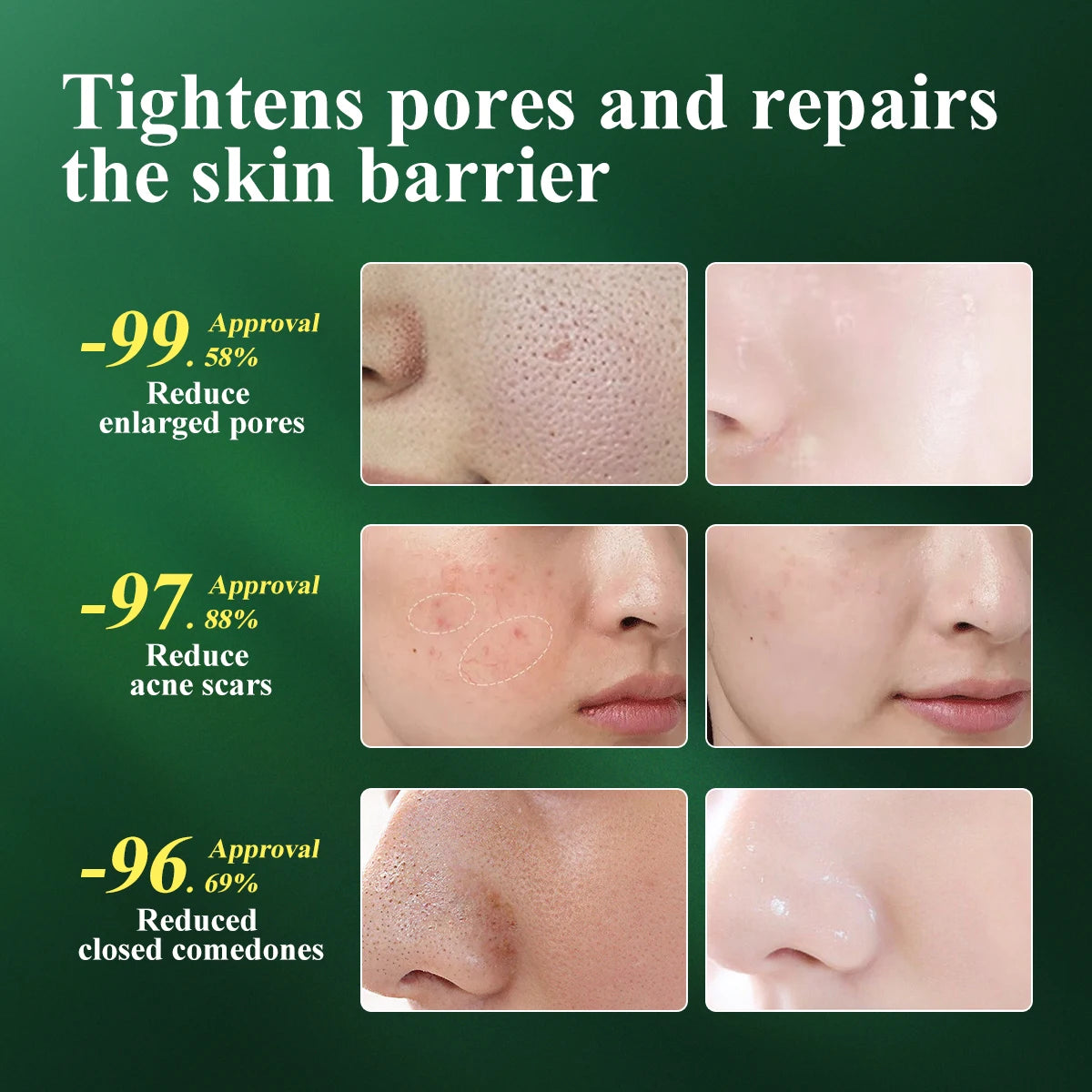 Pore shrinking serum, pore tightening essence, minimize pores, best serum for large pores, oil control serum, hydrating pore treatment, skin firming serum, refining skin texture, smooth skin essence, deep pore treatment, acne-prone skin serum, anti-aging pore serum, lightweight face serum, pore-reducing skincare, non-greasy serum, skin tightening essence, best serum for oily skin, facial serum for dry skin, hydration and oil control, repairing skin serum, pore minimizer solution.