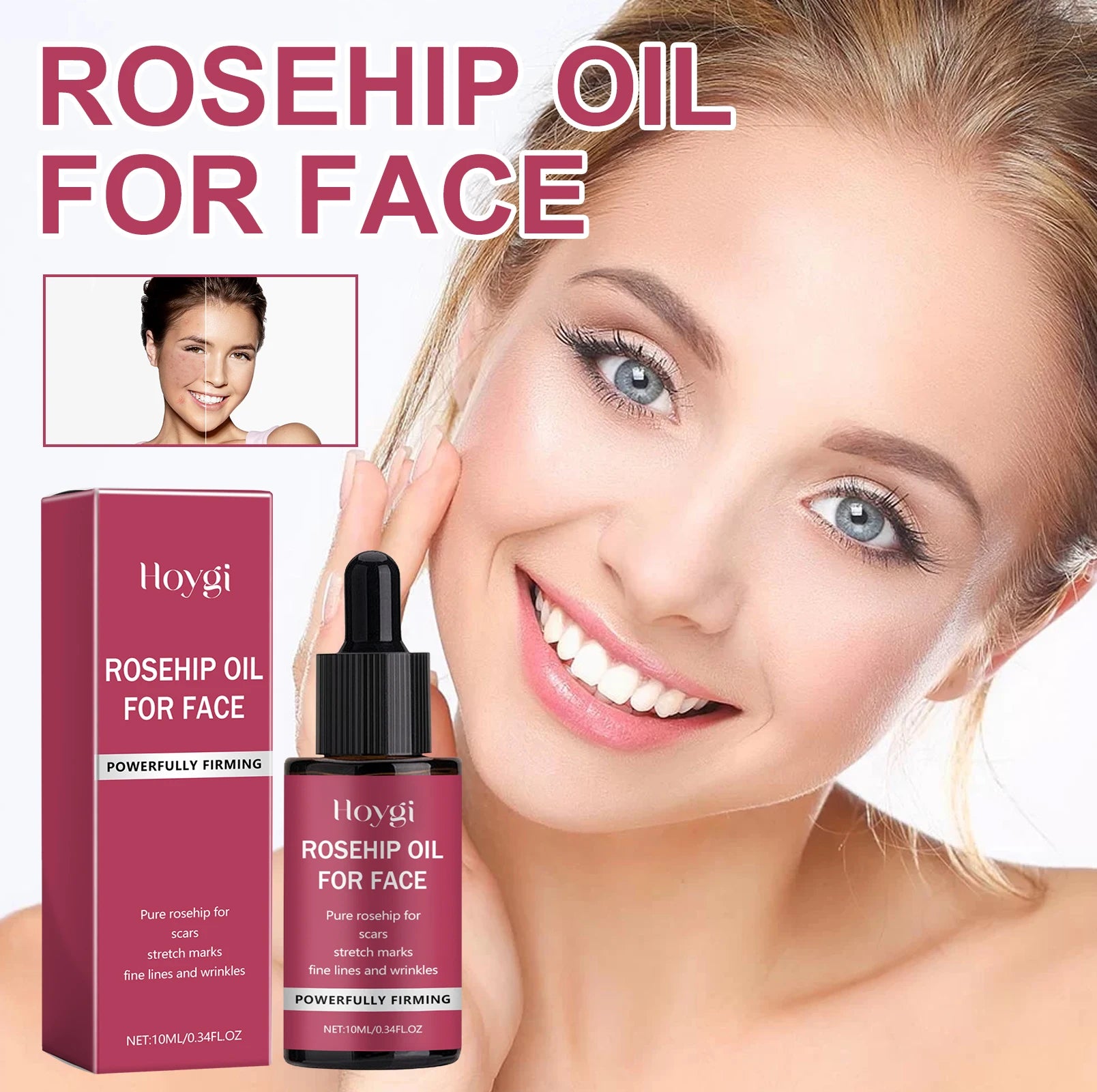 Pure rosehip oil, anti-aging face oil, best oil for wrinkles, rosehip oil for acne scars, natural facial moisturizer, skin repair oil, anti-wrinkle face oil, organic rosehip oil, lightweight face oil, oil for blackheads, fade dark spots, reduce fine lines, glowing skin oil, firming face oil, deep hydration facial oil, non-greasy skincare oil, sensitive skin moisturizer, best face oil for dry skin, smooth skin oil, rejuvenating facial serum