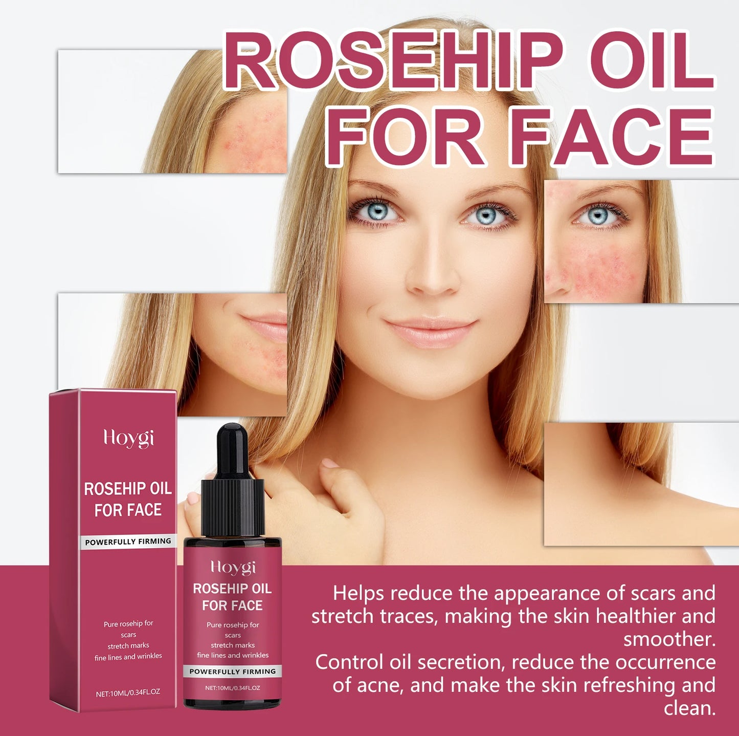 Pure rosehip oil, anti-aging face oil, best oil for wrinkles, rosehip oil for acne scars, natural facial moisturizer, skin repair oil, anti-wrinkle face oil, organic rosehip oil, lightweight face oil, oil for blackheads, fade dark spots, reduce fine lines, glowing skin oil, firming face oil, deep hydration facial oil, non-greasy skincare oil, sensitive skin moisturizer, best face oil for dry skin, smooth skin oil, rejuvenating facial serum