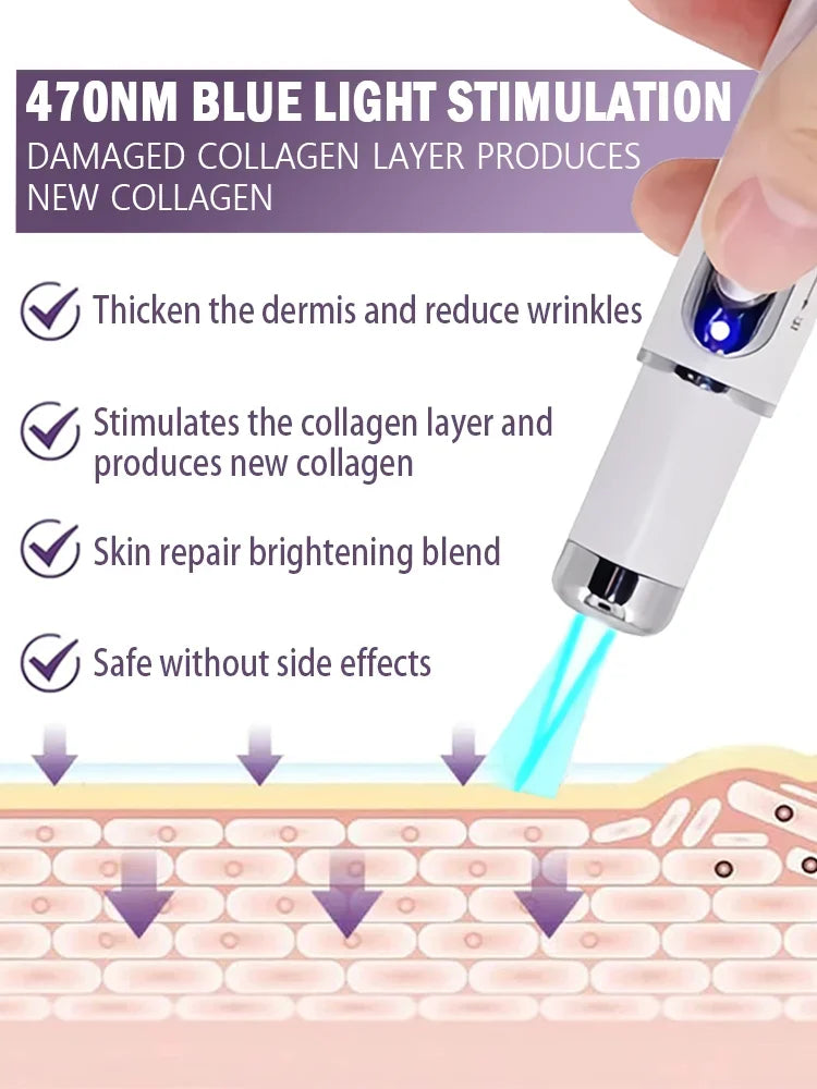 Laser wrinkle remover, wrinkle eraser laser pen, anti-aging laser device, anti-wrinkle serum, remove wrinkles fast, best laser for wrinkles, laser therapy for fine lines, home laser treatment for wrinkles, skin tightening laser, face lifting device, wrinkle reduction tool, anti-aging skincare, collagen booster, crow’s feet removal, forehead wrinkle remover, sagging skin treatment, smooth fine lines, non-invasive wrinkle solution, best home laser for anti-aging, skin rejuvenation laser, under-eye wrinkle tre